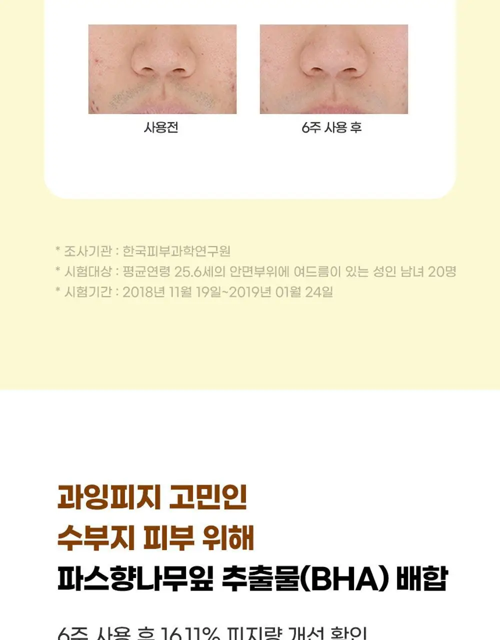[트러블/과잉피지완화]앰플엔 아크네샷 앰플 30ml 상세페이지 19